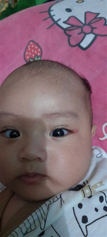 Ujung mata merah pada bayi 3 bulan