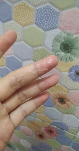 ตั้งครรภ์37+3วีคคะ