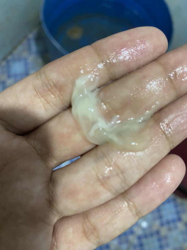 38 สัปดาห์ แบบนี้คือมูกใสหรือมูกเลือดค่ะ ต้องไปโรงพยาบาลไหม
