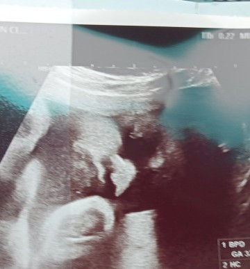 32week หนัก 2011 g