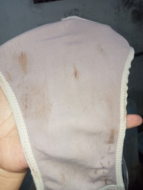 Bund mau tanya
Maaf kalau jijik lihat fotonya 🙏😭