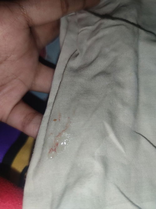 CLEAR DISCHARGE NA MAY KONTING DUGO