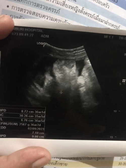แม่ๆช่วยดูหน่อยค่ะ