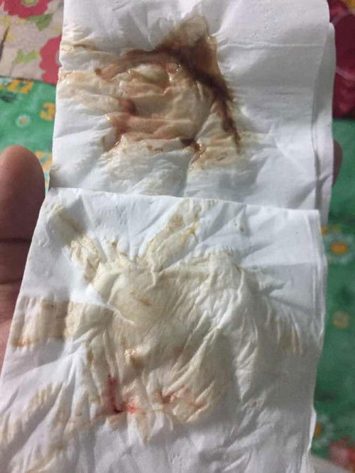 อันตรายไหมค่ะ