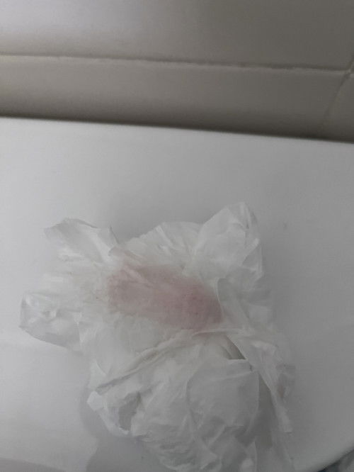 อันตรายมั้ยค่ะเช็ดแล้วเป็นสีนี้