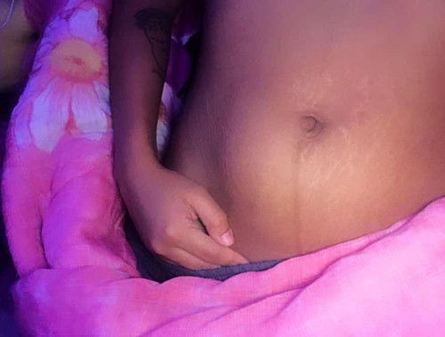 Is this normal po for 8 weeks