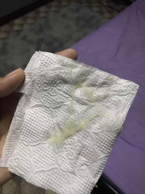 มูกหรือตกขาวคะแม่ๆ39+5w