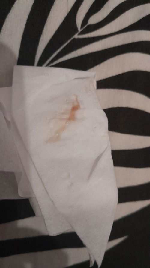 Ini flek tanda akan lahiran apa bukan ya?