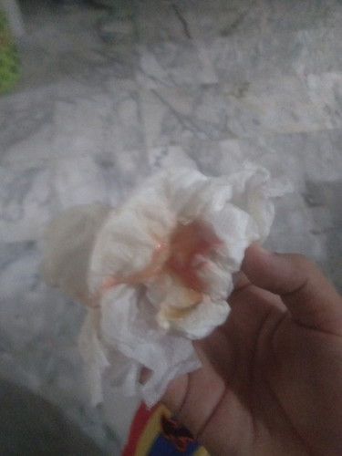 37วีควันนนี้