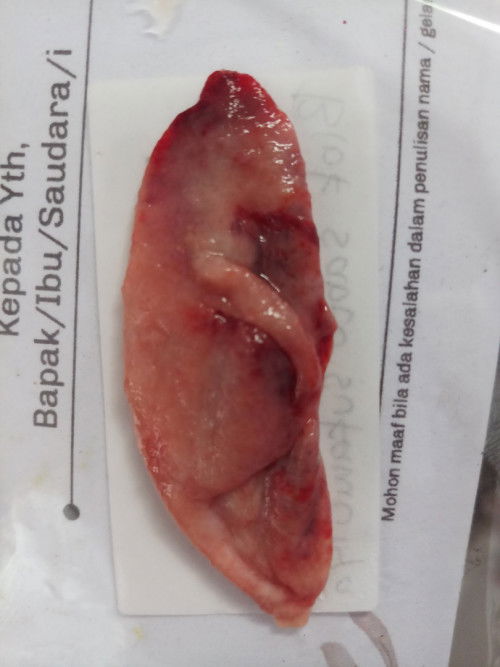 Keguguran atau bukan?