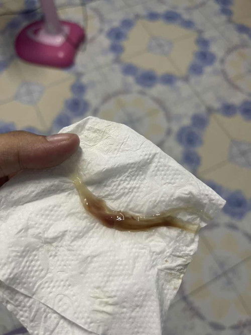 สอบถามแม่ๆค่ะท้อง39+5มีมูก