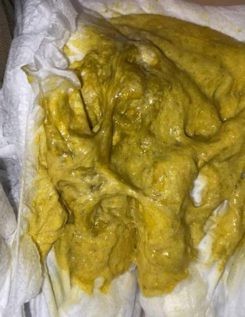 bayi terminum susu basi