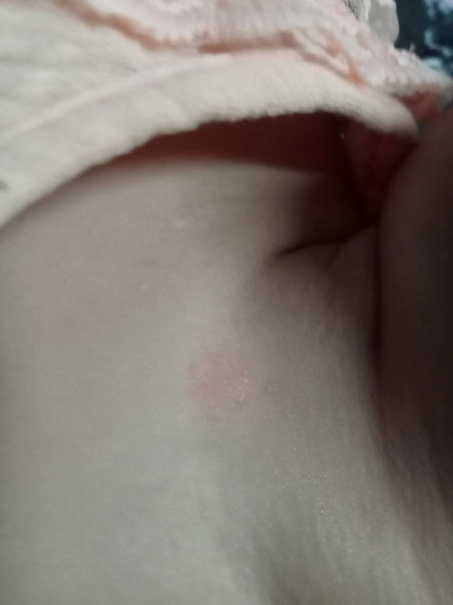 เเบบนี้คอลูกเป็นไรคะ ลูกอายุ2เดือนค่ะ