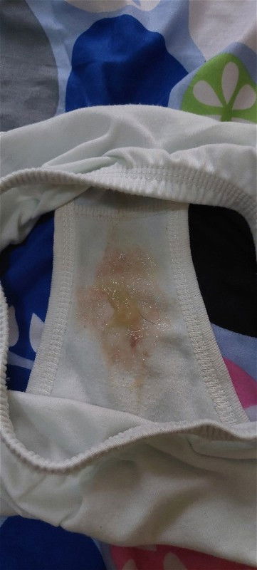 apakah tanda menjelang lahiran?