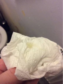 20weeks and 5days napo Ako ngayun nilabasan Ako Ng ganyan normal poba?