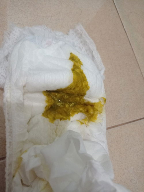 Maaf mau tanya bund,kalau pup bayi warnanya hijau sehari 3-5 kali apa itu diare bund?