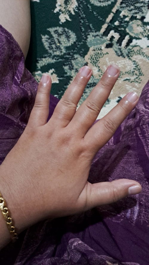 Kaki dan tangan bengkak