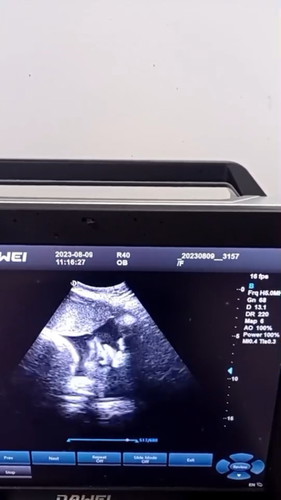 คิดว่า นน น้องโอเครไหมคะ