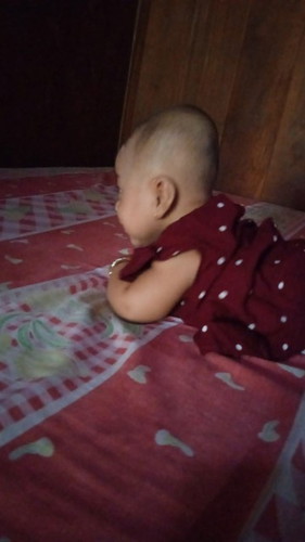 Bentuk kepala dedek seperti ini apakah normal bun? Kalau peyang apakah bisa normal bun?
