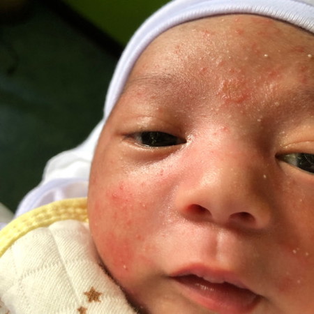 hello mga mommy ganito din po ba anakis nyo?