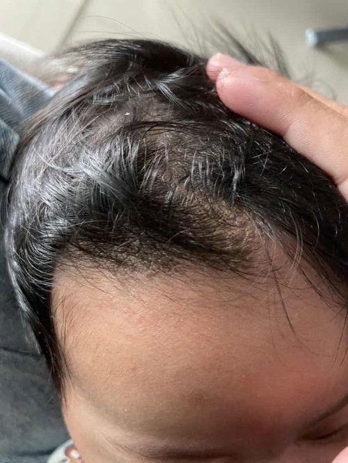 หนังหัวน้องเป็นแบบนี้อันตรายมั้ยคะ