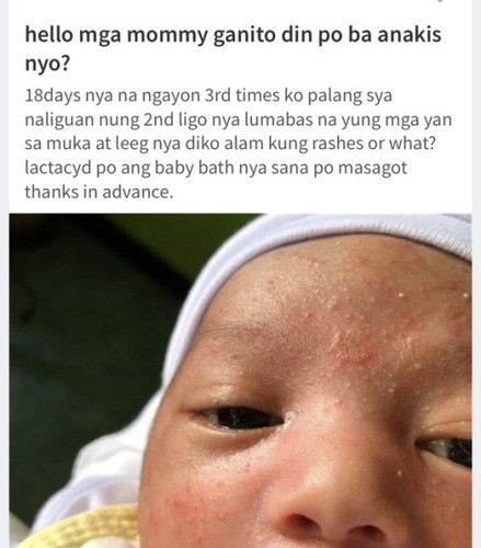 ganito din po ba baby nyo?