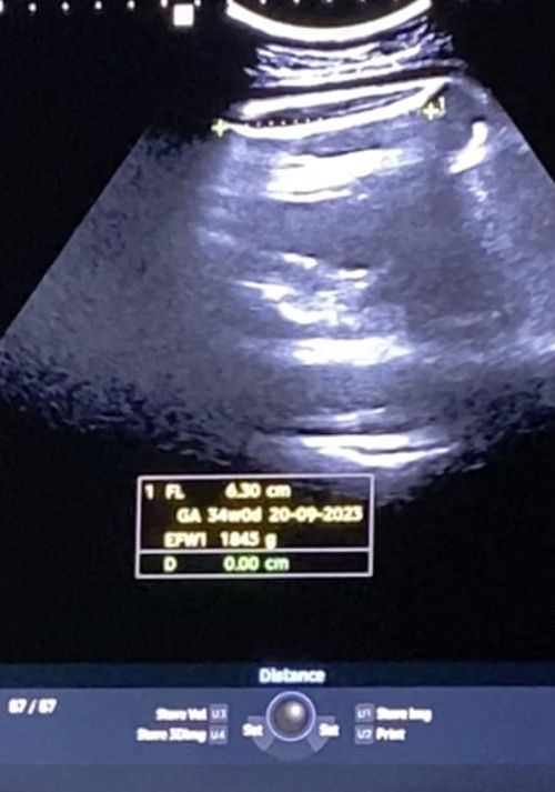 น้ำหนักลูก ทีมเดือนกันยายน