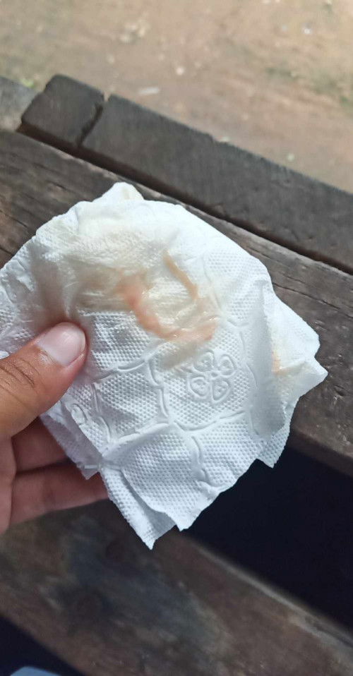 อายุครรภ์ 40 สัปดาห์