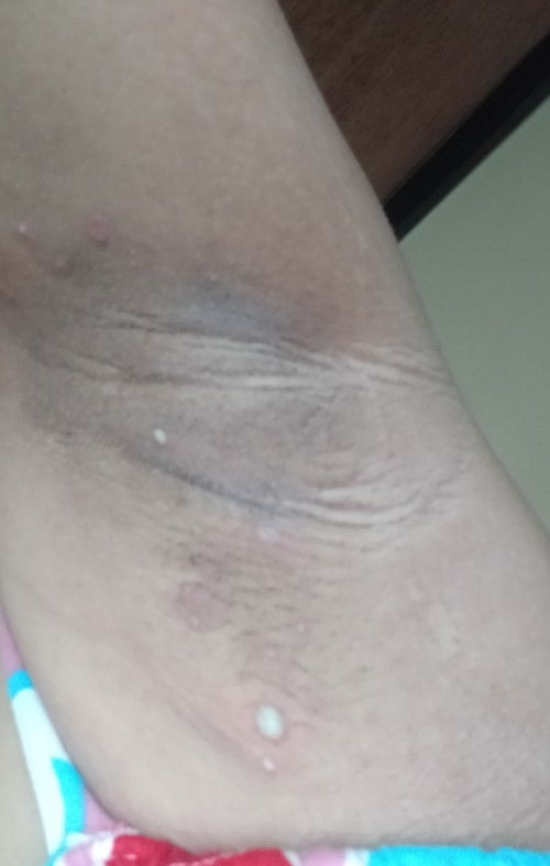 Maliliit na nana sa kili kili