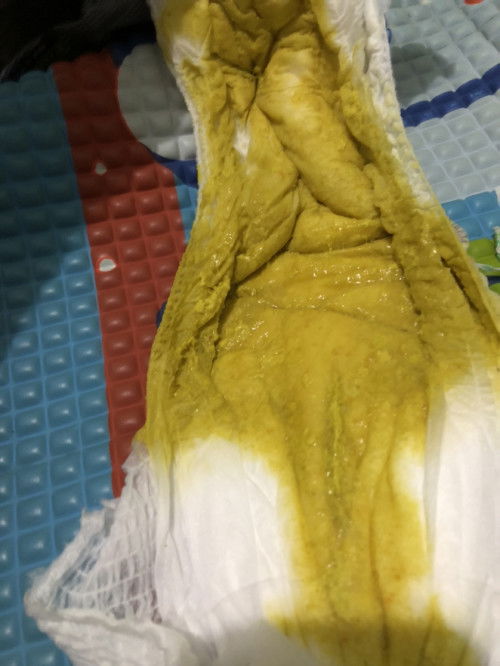 Pup bayi usia 6bulan cair