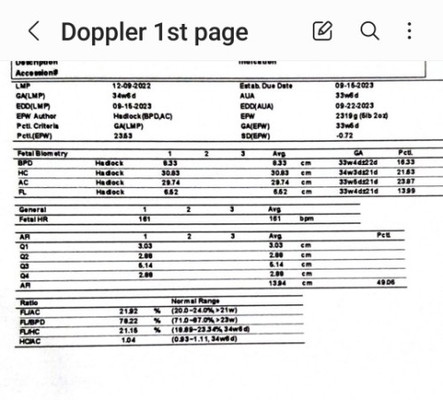 Doppler Studies