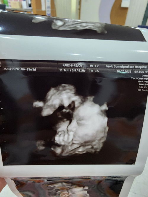 ภาพอัตราซาว์