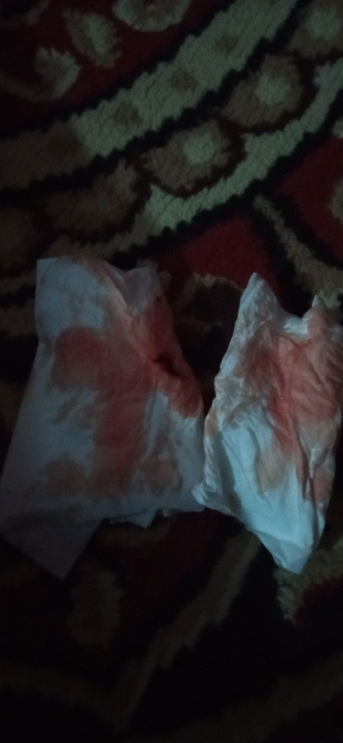 Sering flek sampai pendarahan sejak awal kehamilan