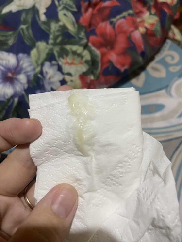 ตกขาวสีอะไรคะ