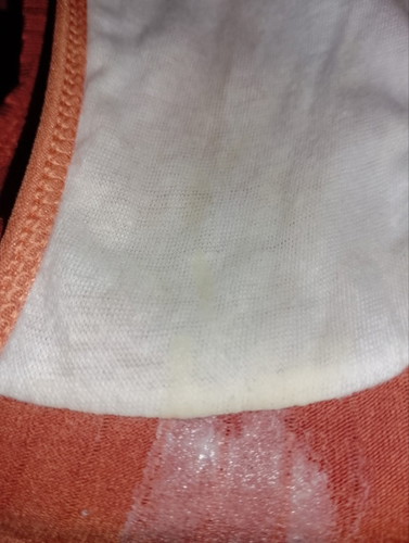 Mucus plug