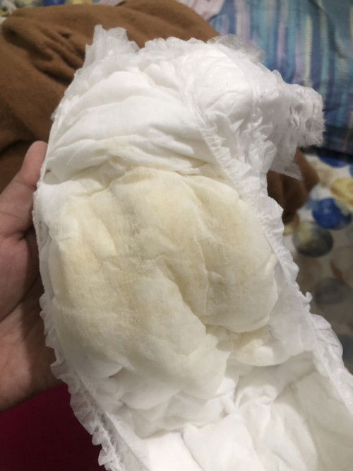 PIPISNYA KERUH ATAU NORMAL?