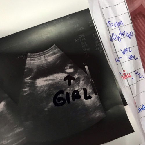 อยากทราบว่าแบบนี้คือผู้หญิงใช่ไหมคะแม่ๆ