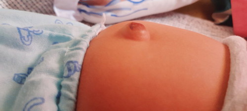 navel (pusod) sticking out