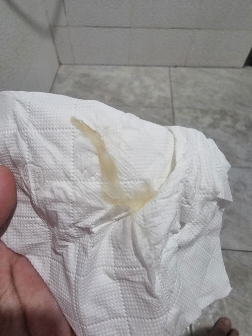 สอบถามแม่ๆที่มีประสบการณ์ค่ะ