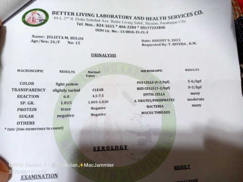Urinalysis result.