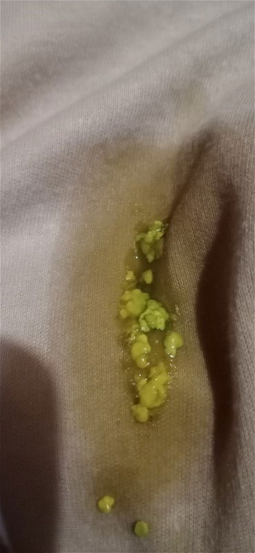 Bab bayi 3 bulan full dbf.