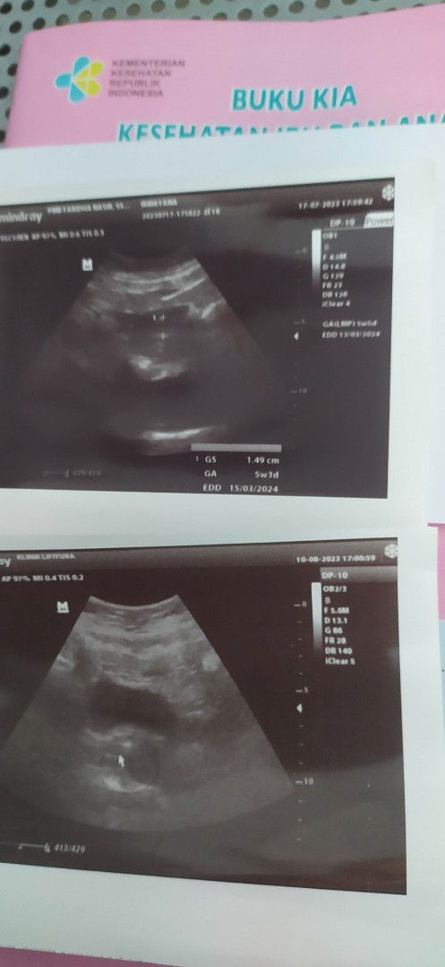 Penebalan rahim usia 9 week?