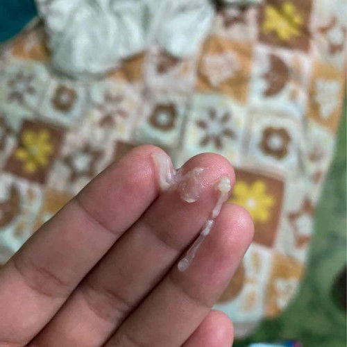 มีมูกใสออกมา