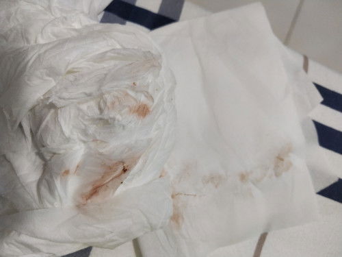 Apakah tanda flek mau melahirkan??