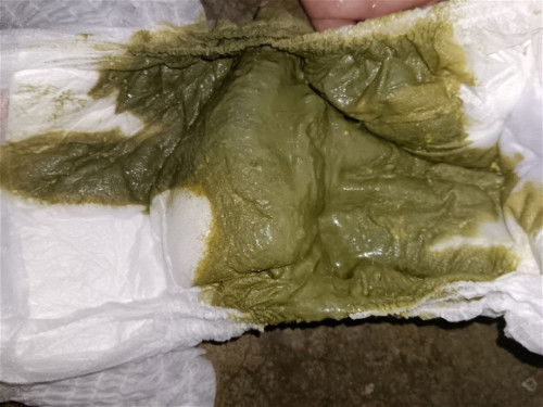 Najis bayi darkgreen