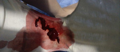 Maaf mau tanya, apakah keluar gumpalan darah tanda mau lahiran? Sebelumnya sempat kram seperti haid