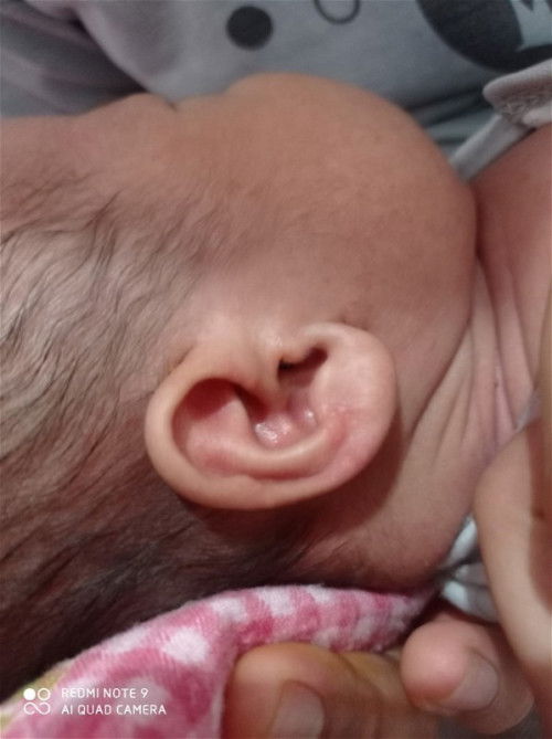 Bintik-bintik pada bayi