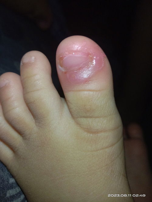 𝘱𝘢𝘴𝘢𝘨𝘰𝘵 𝘱𝘰  😢