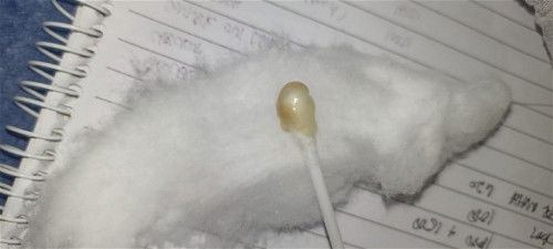 When should I go To the hospital?