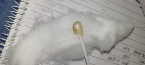 When should I go To the hospital?